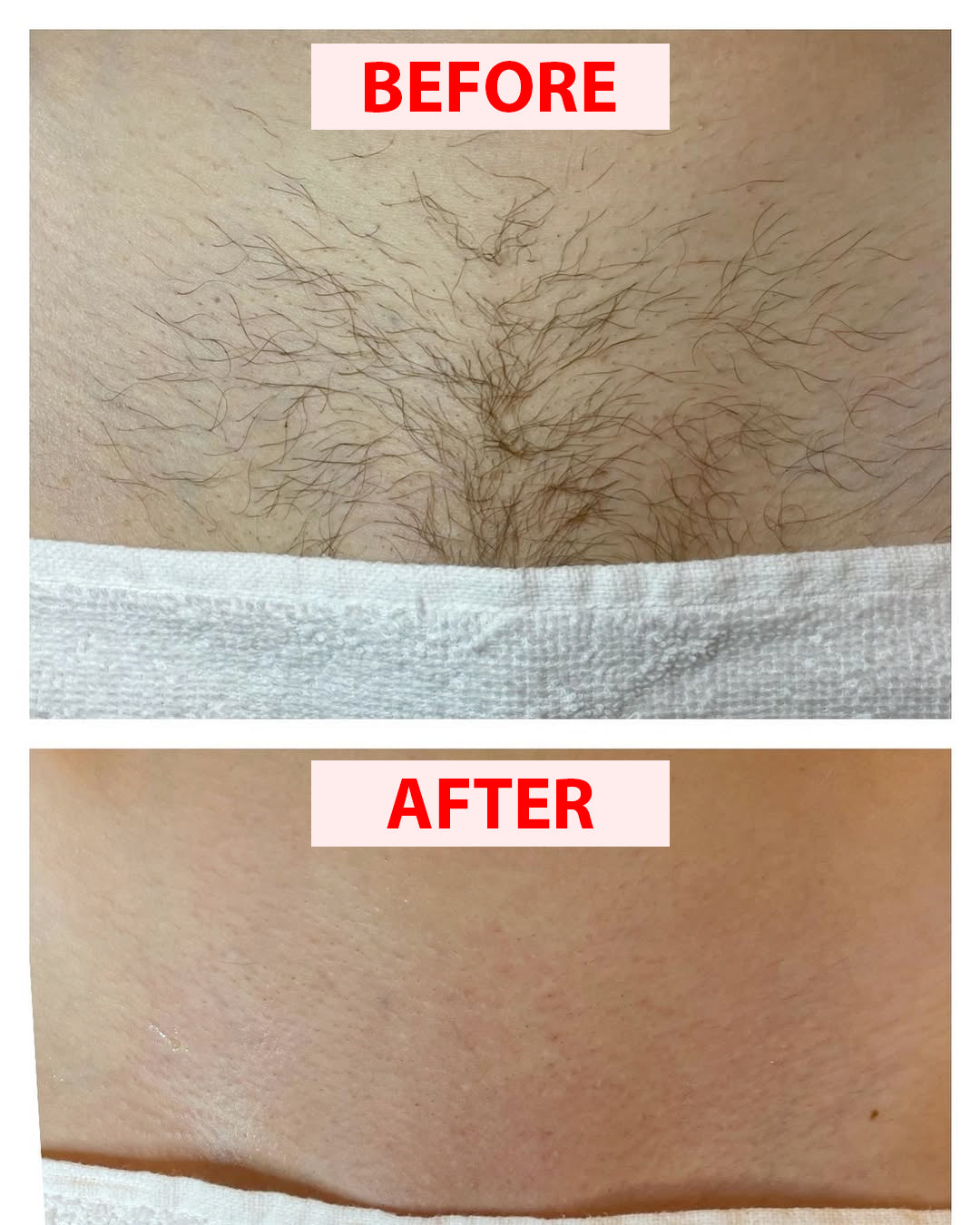 Women’s Body Shaver
