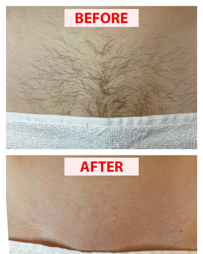Women’s Body Shaver